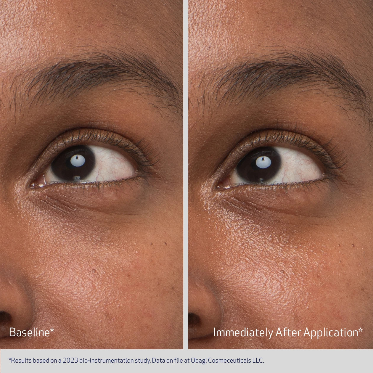 Obagi Medical Daily Hydro-Drops Eye Gel Cream 15ml