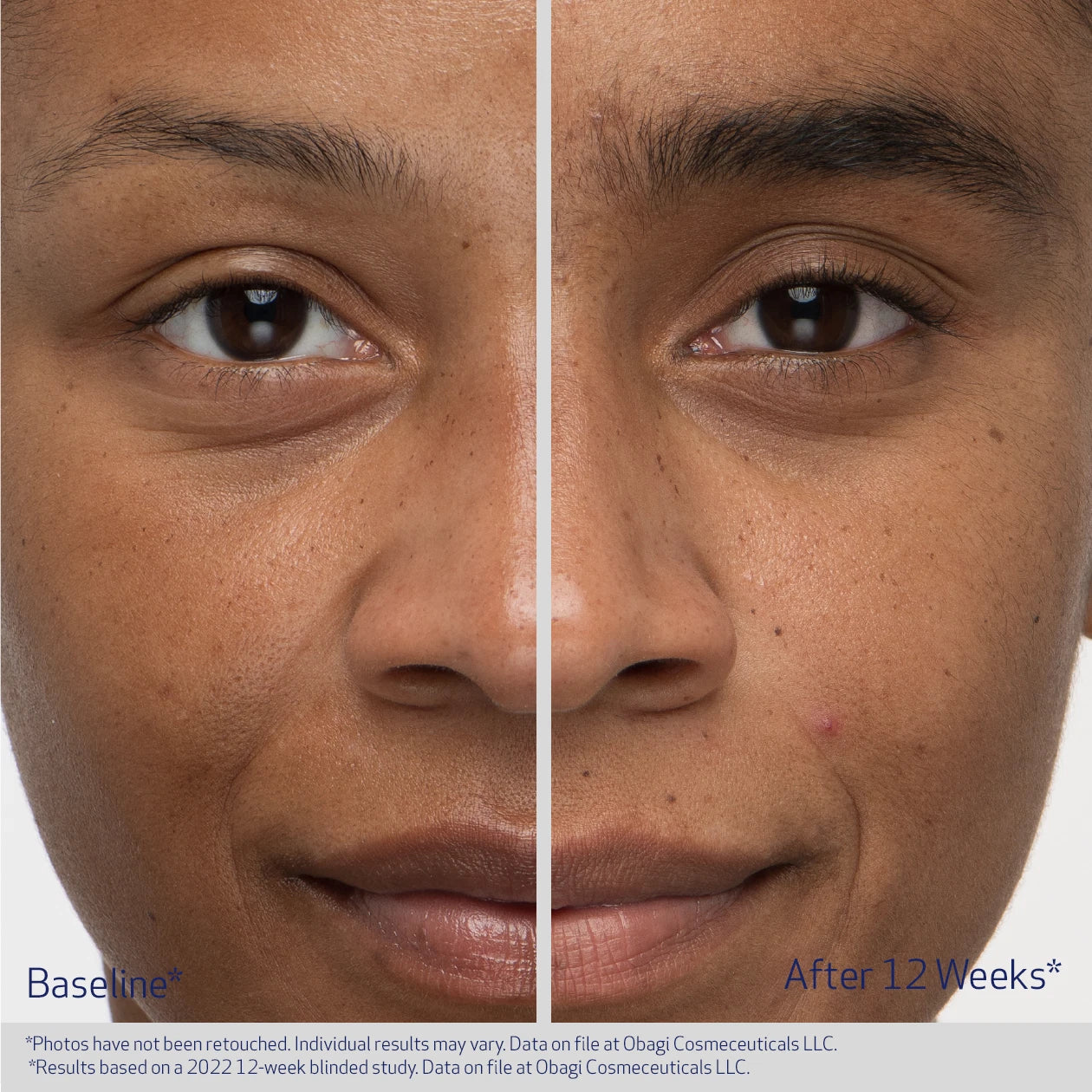 Obagi Medical Nu-Cil Eyebrow Boosting Serum 5ml