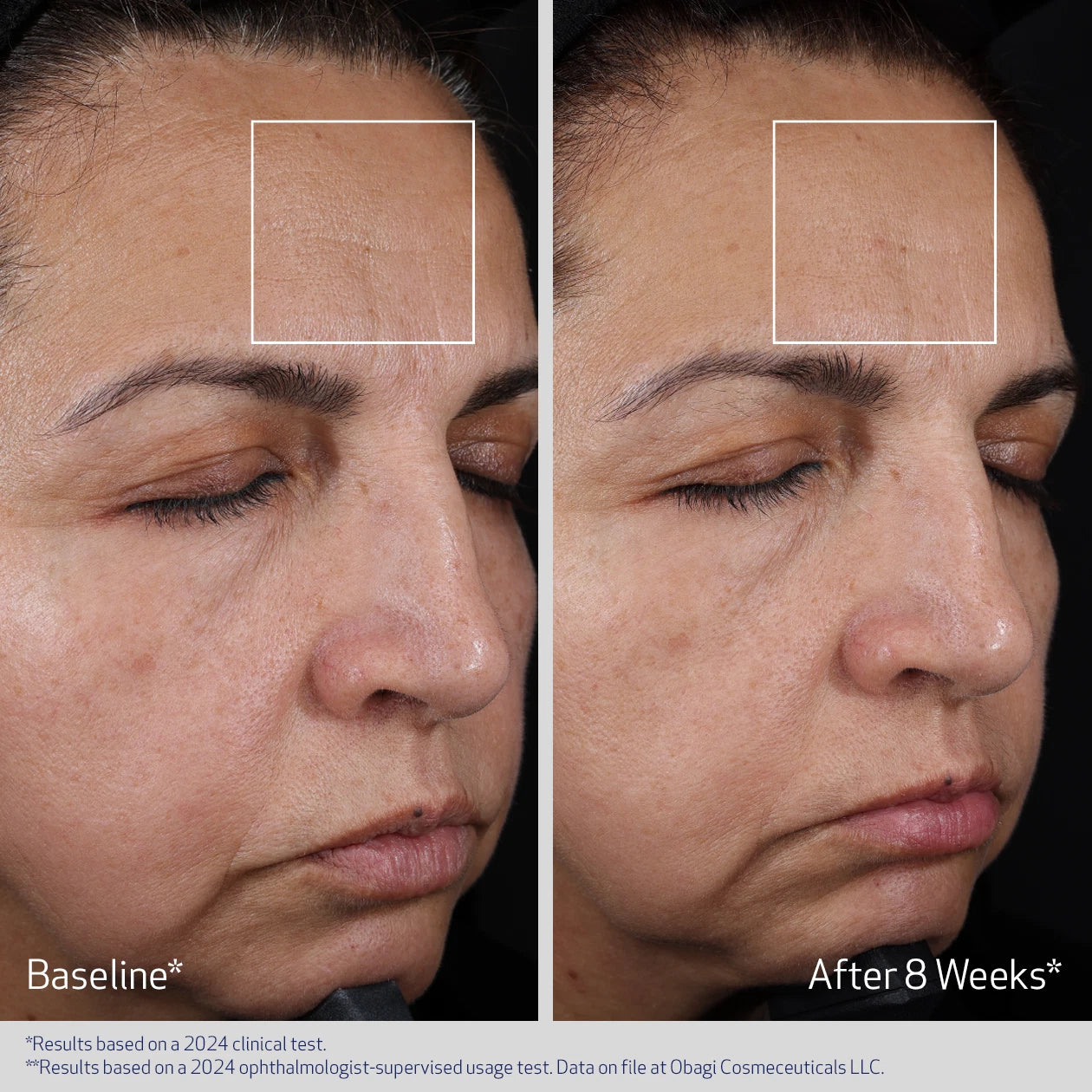 Obagi Medical Elastiderm Advanced Filler Concentrate 20ml