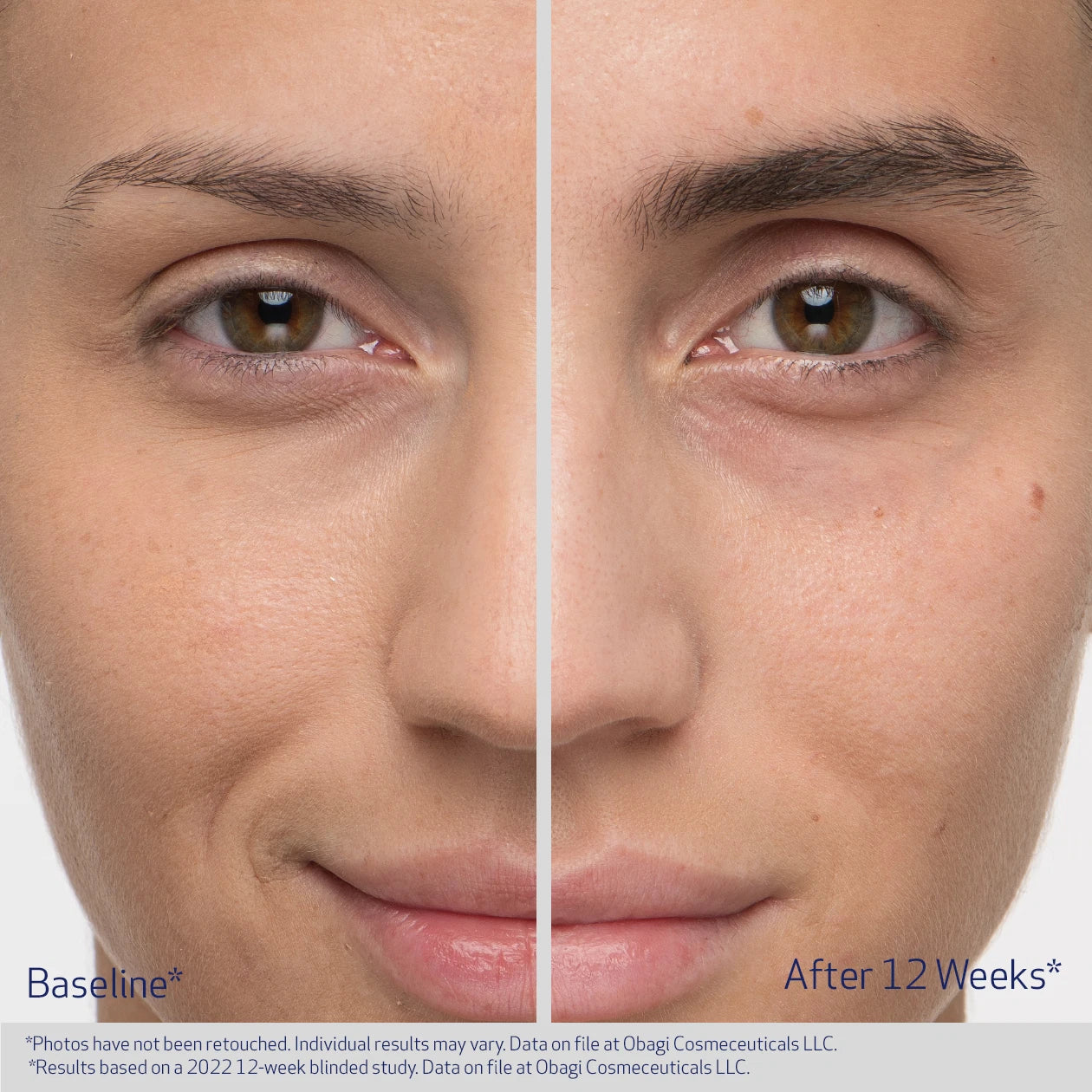 Obagi Medical Nu-Cil Eyebrow Boosting Serum 5ml